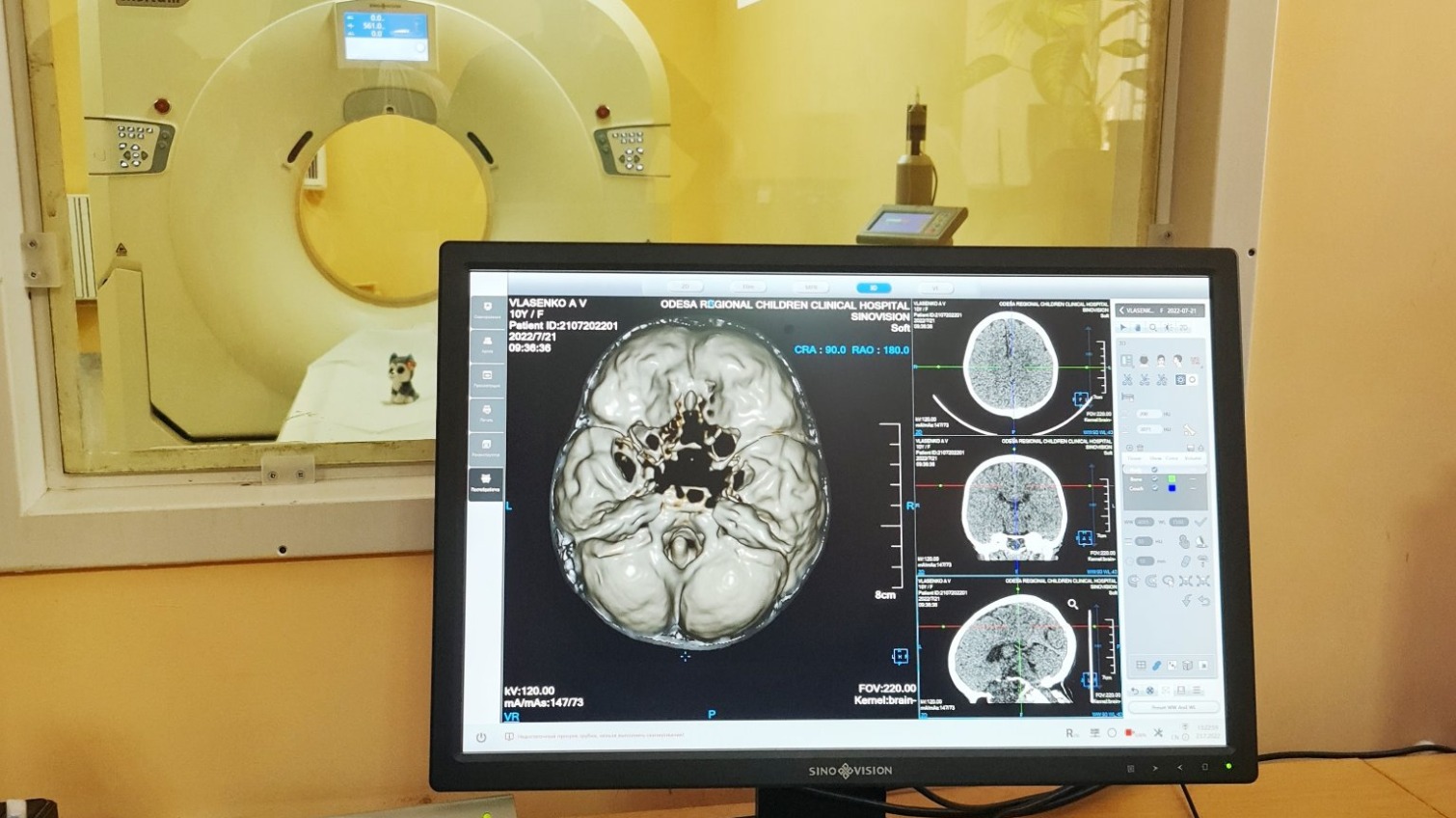 В дитячій лікарні Одеси встановили комп’ютерний томограф (фото) «фото»
