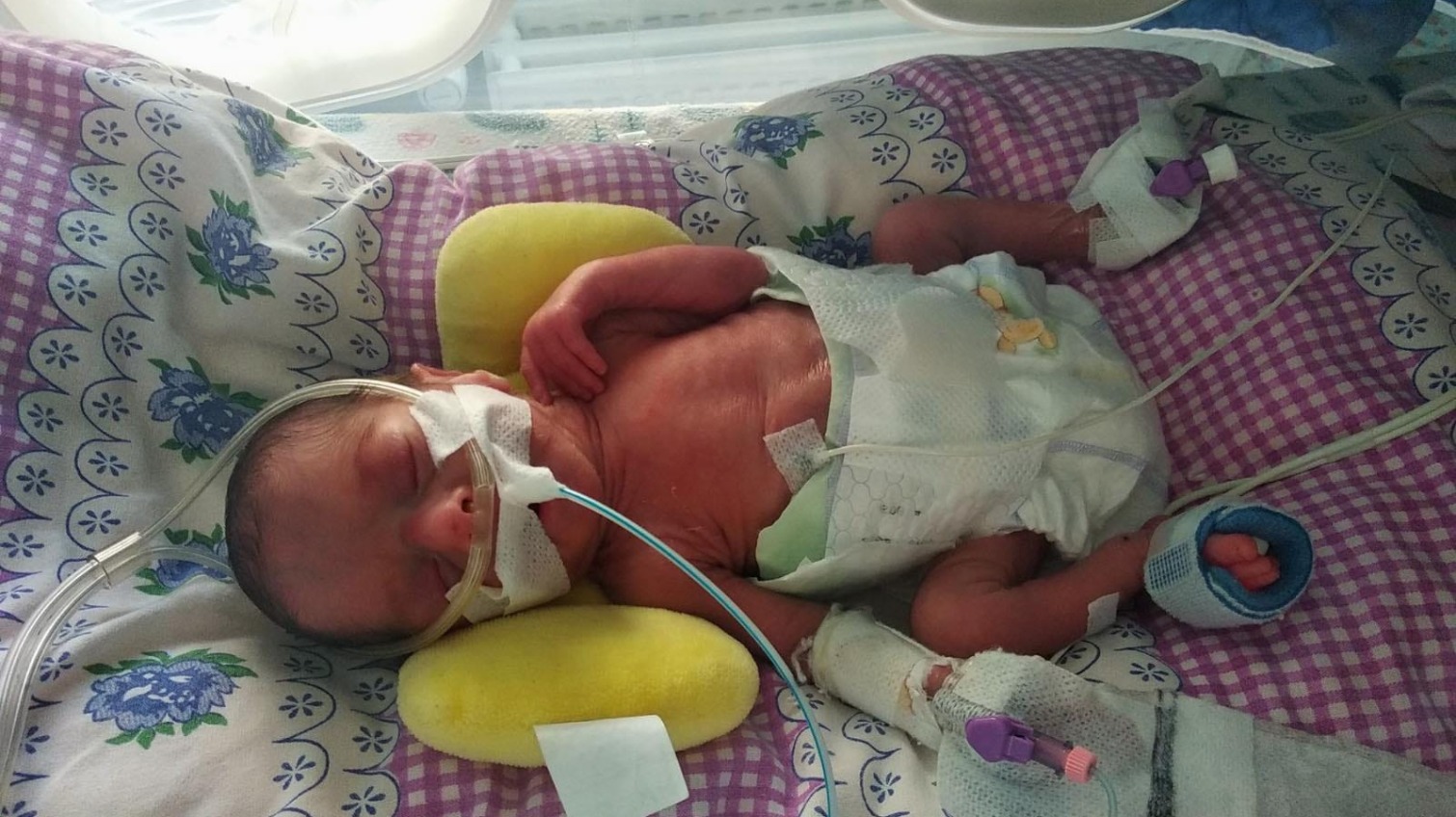 Одеські медики врятували життя двом немовлям вагою менше кілограма (фото) «фото»
