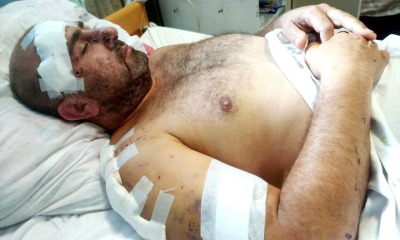 Допомога пораненим хлопцям «фото»