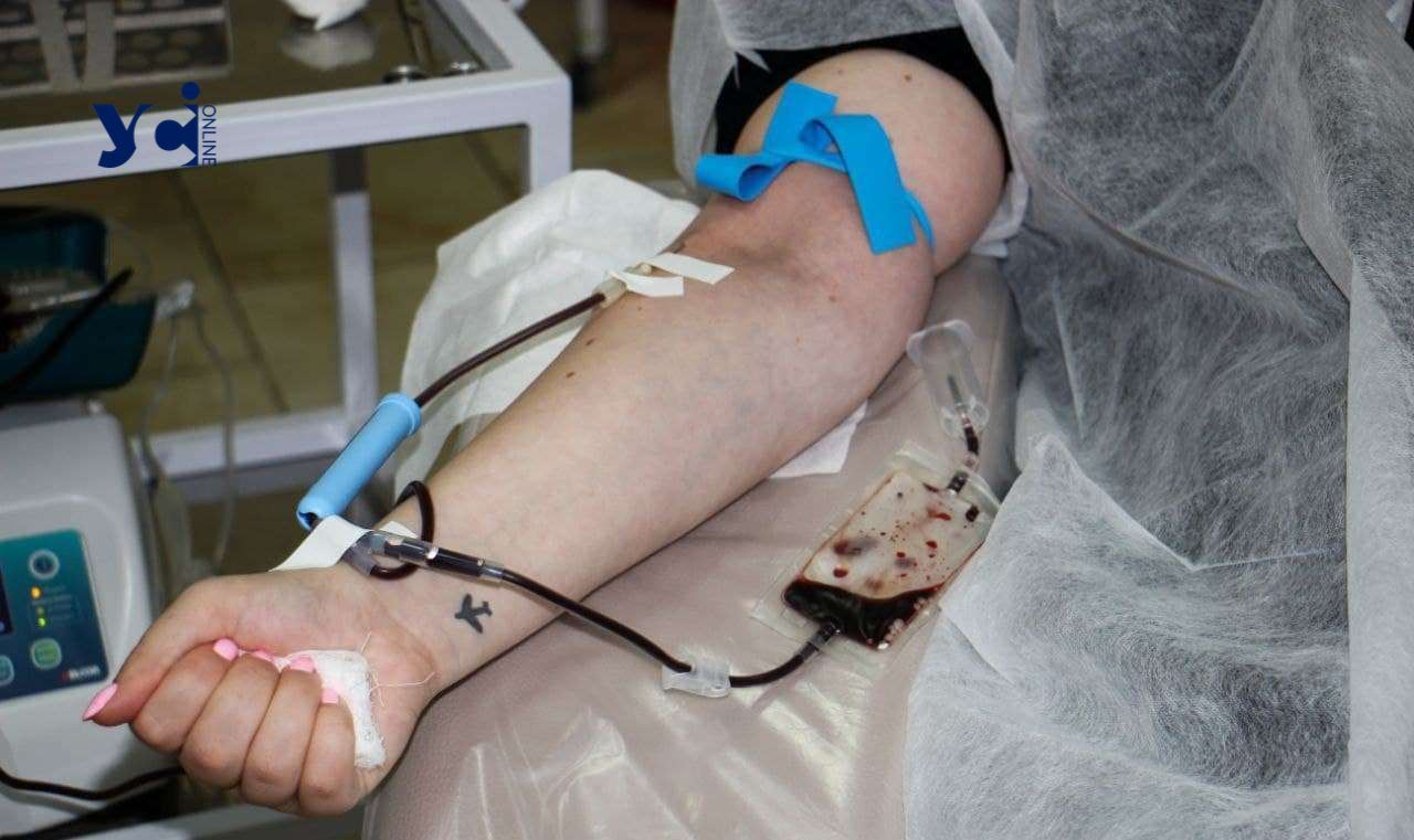 В Одесі шукають донорів крові 4 и 1+ «фото»
