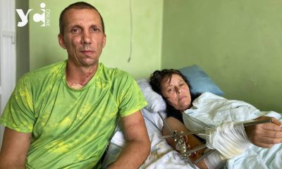 Унікальна операція: українські лікарі врятували ногу жертві агресії РФ (фото) «фото»