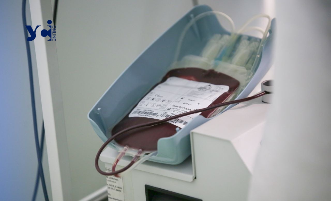 Зібрали половину: в Одесі триває збір на центрифугу для переливання крові «фото»