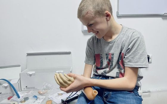У центрі «Незламні» 13-річному хлопцю з Одещини виготовляють протез (фото) «фото»
