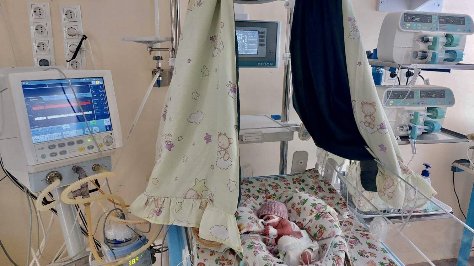 Одеські лікарі прооперували немовля вагою 660 гр «фото»