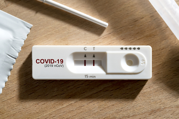 На Одещину доставили 17,2 тисяч антиген-тестів для визначення COVID-19 «фото»