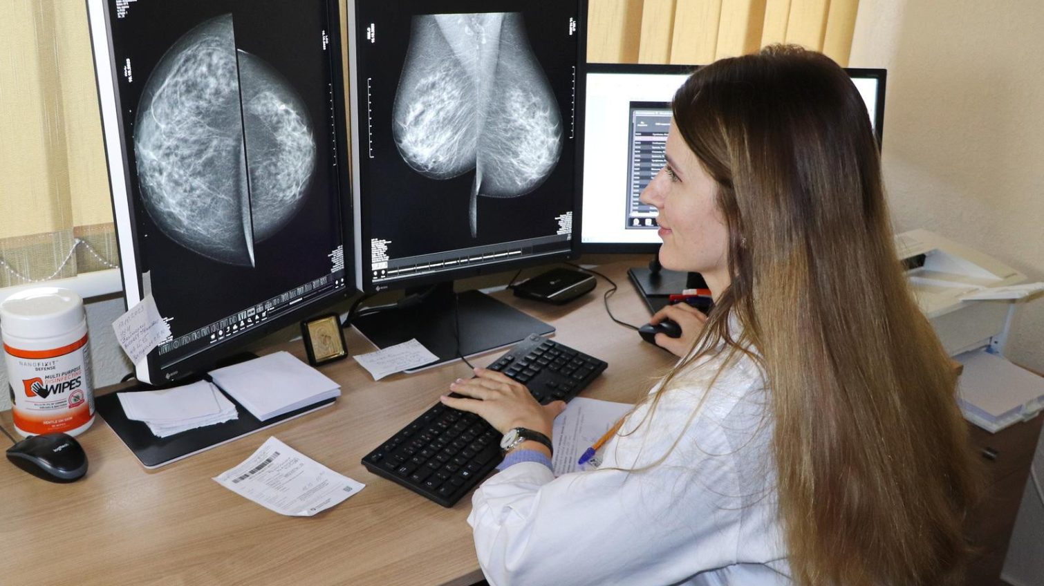 Тиждень профілактики раку молочної залози: де в Одесі можна пройти діагностику безоплатно (фото) «фото»