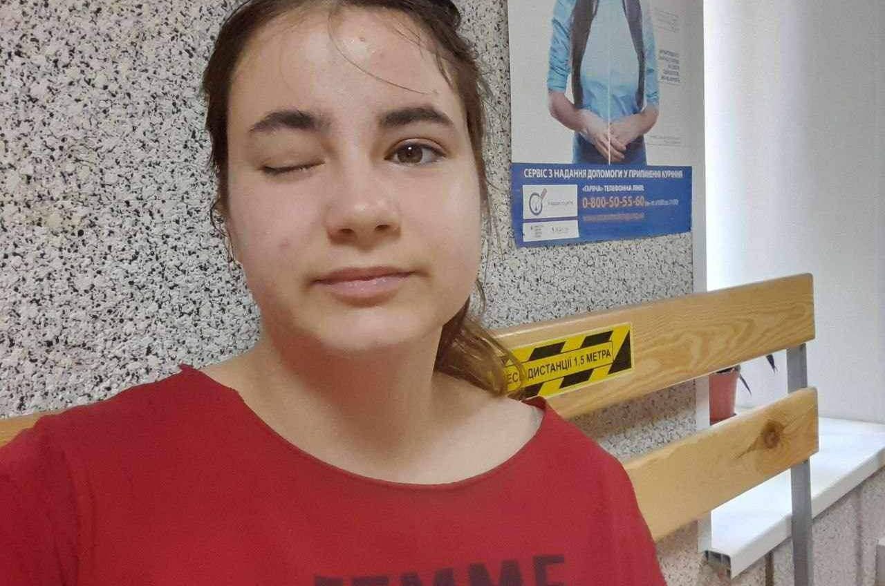 17 річна дівчина, яка виїхала з окупації до Чорноморська, потребує допомоги на реабілітацію після важкої хвороби (фото) «фото»