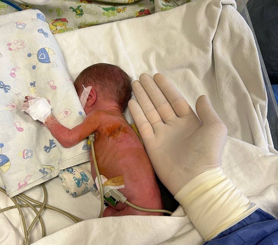 Одеські дитячі лікарі врятували життя новонародженої дитини: подробиці (фото) «фото»