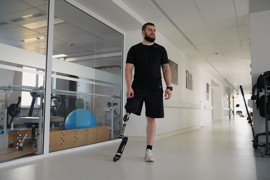 Незламний: 25-річний випускник Одеської військової академії втратив на війні ногу, але буде бігати «фото»
