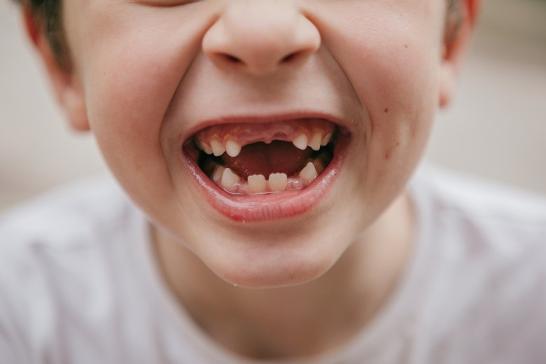 В Одесі на день профілактики стоматологічних захворювань у дітей можна пройти безкоштовний огляд: де саме «фото»