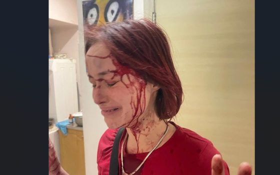 В Одесі розпочато розслідування побиття дівчини чоловіком у військовій формі – але попередня версія поліції зовсім інша «фото»