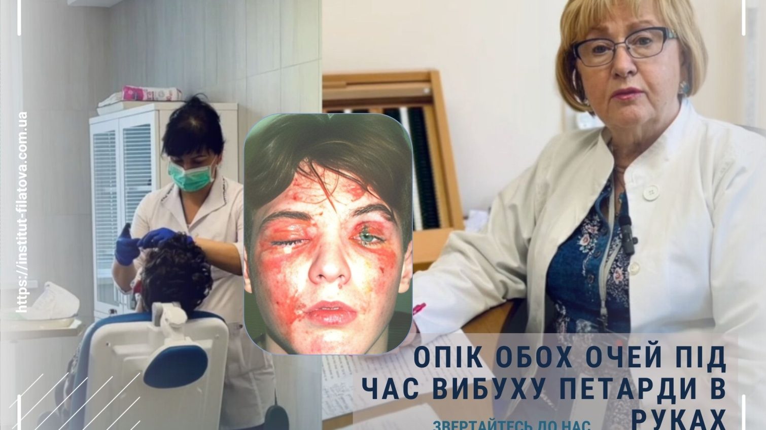 Лікарі Інституту Філатова в Одесі врятували зір 15-річному хлопцю після вибуху петарди «фото»