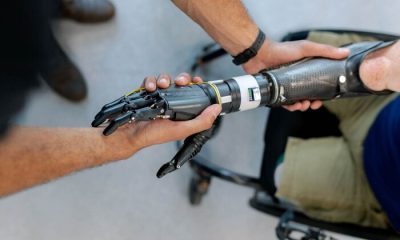 Цього року українці безкоштовно отримали майже 130 тисяч засобів протезування usionline.com Цього року українці безкоштовно отримали майже 130 тисяч засобів протезування «фото»