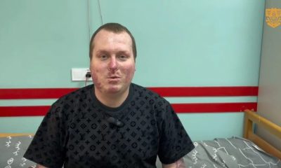 Повернення до життя: як медики Одеси врятували поліцейського з 85% опіків «живим піском» usionline.com Повернення до життя: як медики Одеси врятували поліцейського з 85% опіків «живим піском» «фото»