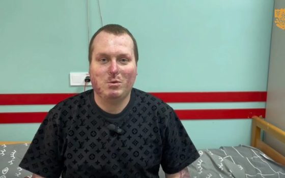 Повернення до життя: як медики Одеси врятували поліцейського з 85% опіків «живим піском» «фото»