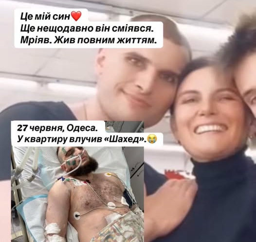 Постраждалому під час дронової атаки на Одесу терміново потрібна донорська кров usionline.com Постраждалому під час дронової атаки на Одесу терміново потрібна донорська кров «фото»