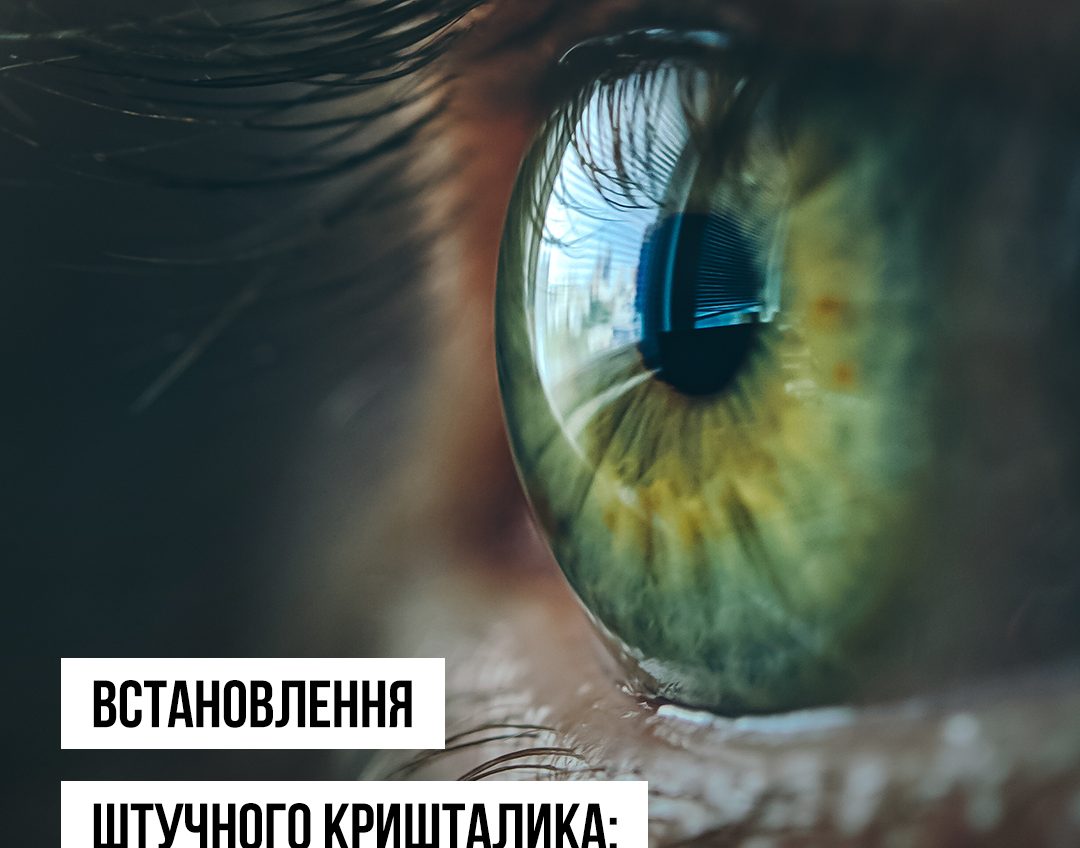 В Одесі пацієнти з катарактою можуть безкоштовно пройти операцію та отримати штучний кришталик «фото»