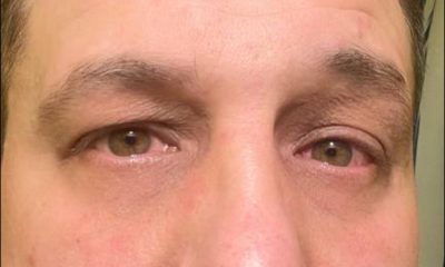 В Одесі ТЦКівці та представники «добровольчого ГО» напали на військового з ортезом (фото) «фото»