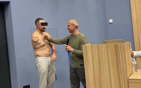 Ботокс проти фантомного болю – українські вчені зробили відкриття «фото»