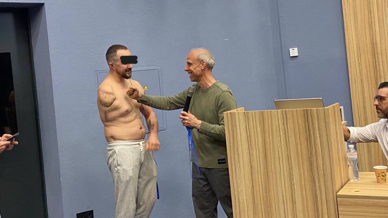 Ботокс проти фантомного болю – українські вчені зробили відкриття «фото»