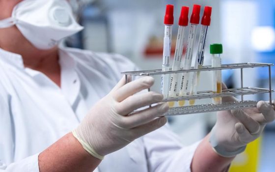 За минулий тиждень в Одесі знизилася захворюваність на ГРВІ та грип «фото»