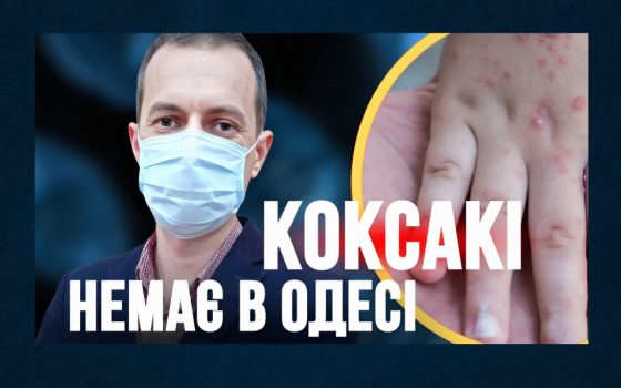 В Одесі немає спалаху вірусу Коксакі, – медики (відео) «фото»