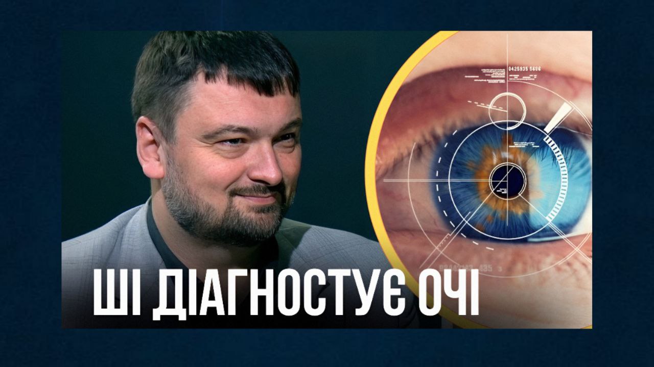Штучний інтелект та цукровий діабет: як діагностика очей допомагає виявляти небезпечну хворобу «фото»