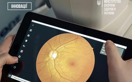 В Україні штучний інтелект допомагає знаходити хвороби очей за кілька секунд «фото»