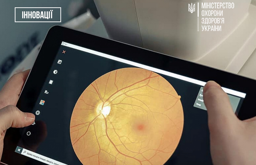 В Україні штучний інтелект допомагає знаходити хвороби очей за кілька секунд «фото»