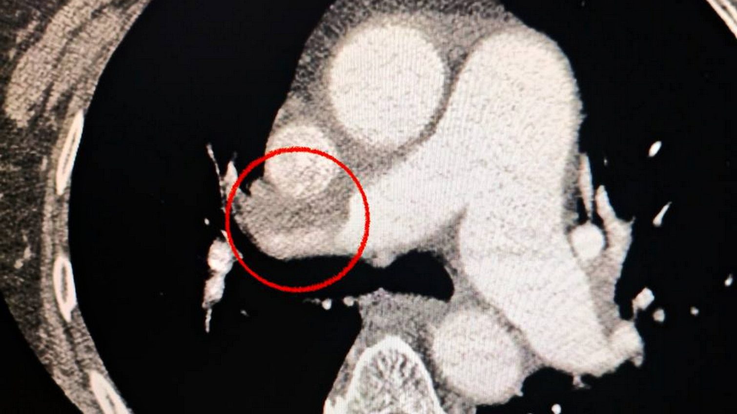 В Одеській лікарні № 10 успішно провели складну операцію (фото) «фото»