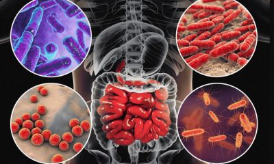 Відключення світла і води в Одеській області підвищують ризик кишкових інфекцій «фото»