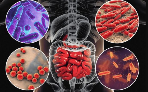 Відключення світла і води в Одеській області підвищують ризик кишкових інфекцій «фото»