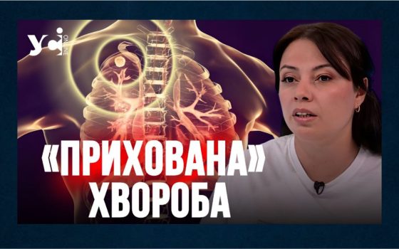 На Одещині зростає кількість випадків позалегеневого туберкульозу: хто в групі ризику та як розпізнати хворобу (відео) «фото»